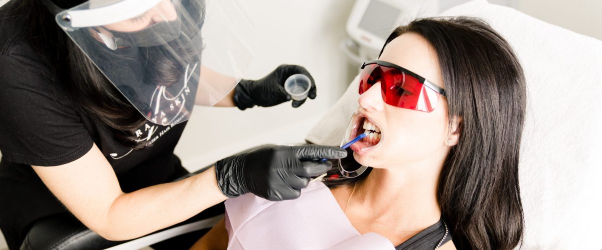 Teeth Whitening services at Araya Skin